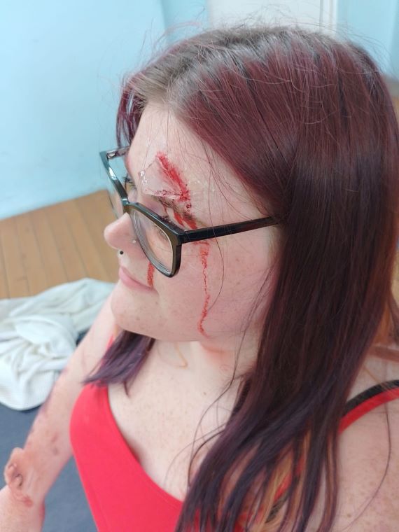 Victim from skills development day.