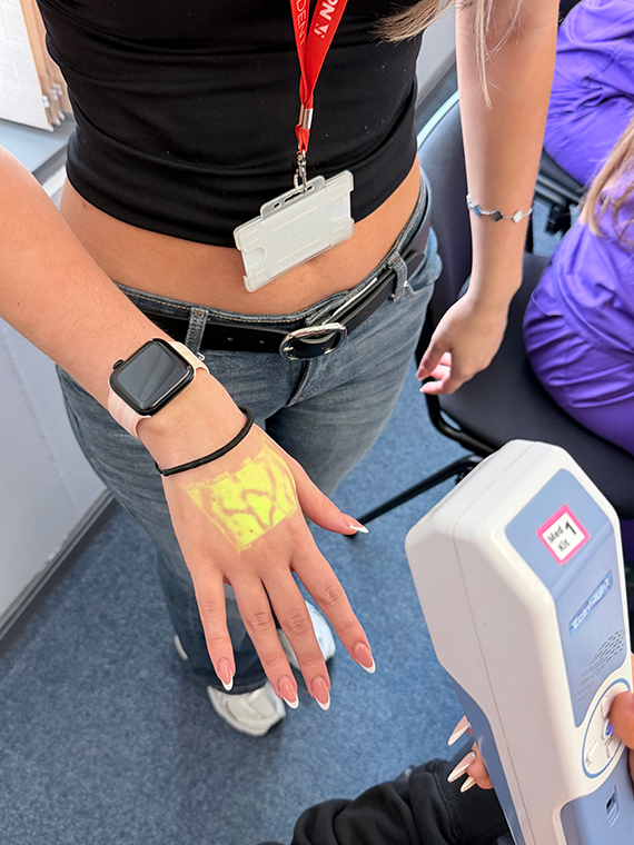 Someone holding their hand up to a white medical device that's making a yellow mark on their hand